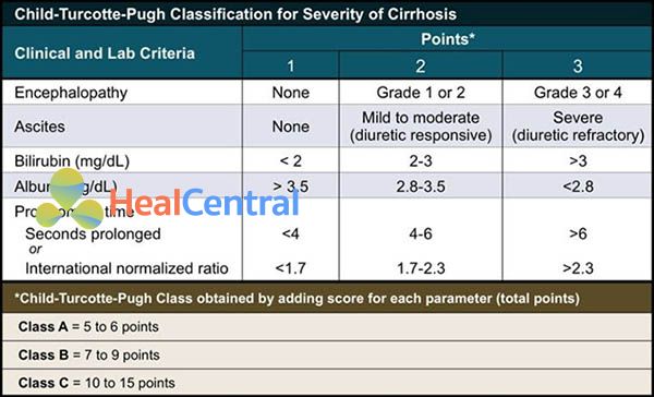 Tiêu chuẩn Child-Pugh về tiên lượng của bệnh nhân xơ gan.