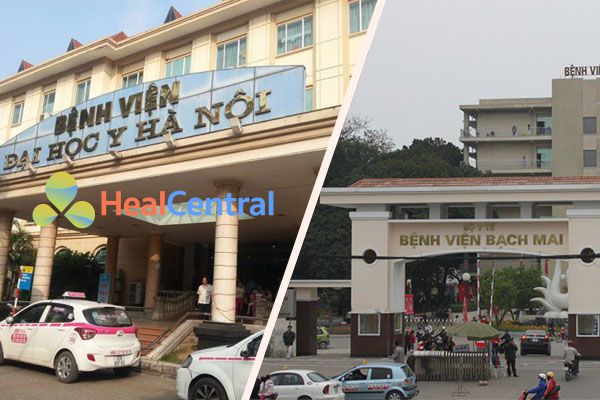 Ở Hà Nội có thể nội soi ở Bệnh viện đại học Y hoặc Bệnh viện Bạch Mai