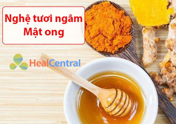 Nghệ tươi ngâm mật ong chữa dạ dày