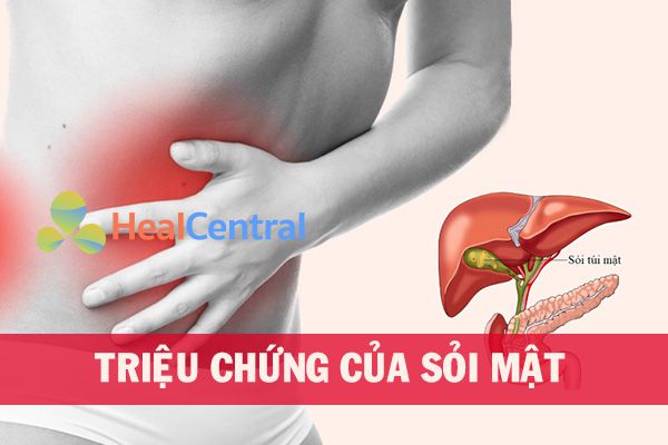 Đau quặn vùng trên rốn là biểu hiện điển hình nhất của sỏi mật