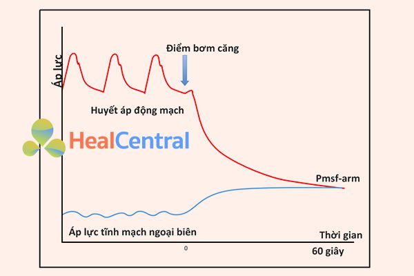 Phương pháp cân bằng động mạch-tĩnh mạch để đo Pmsf-arm ở đầu giường với một bộ ga rô khí nén.