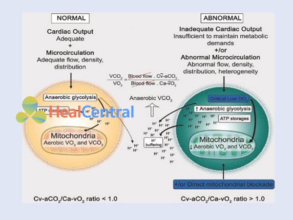 Tỷ lệ giữa CO2 tĩnh mạch-động mạch và O2 động mạch-tĩnh mạch (tỷ lệ Cv- aCO2/Ca-vO2)