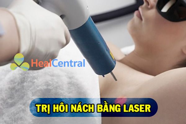 Phương pháp laser trị hôi nách