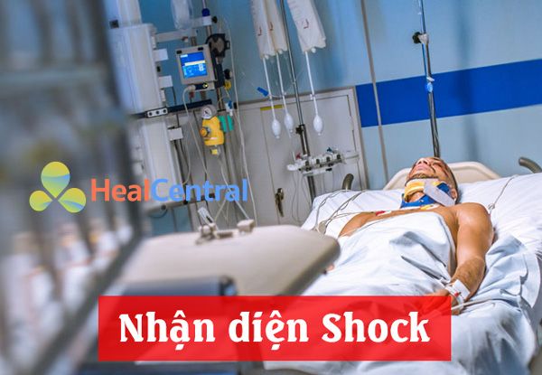 Nhận diện Shock