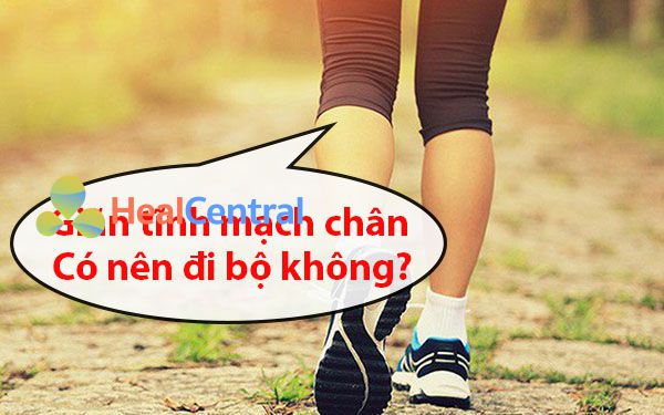 Giãn tĩnh mạch chân có nên đi bộ không?