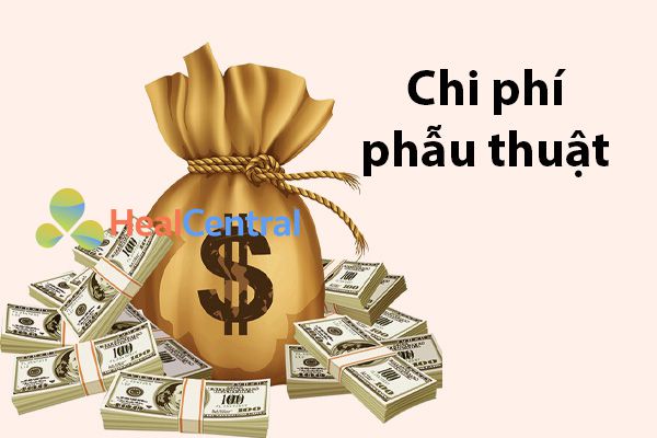 Chi phí phẫu thuật suy giãn tĩnh mạch chân