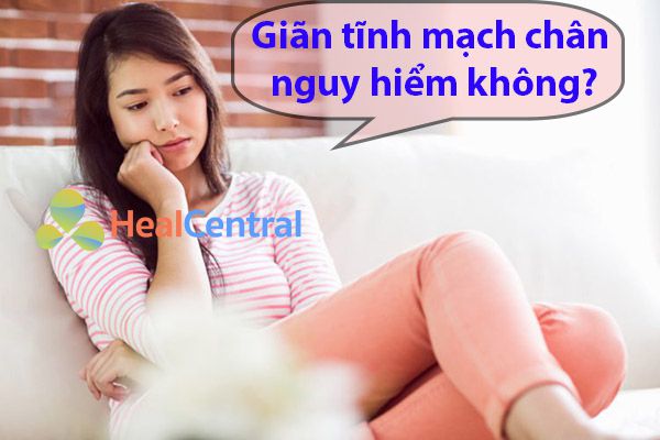 Bệnh suy giãn tĩnh mạch chân có nguy hiểm không?