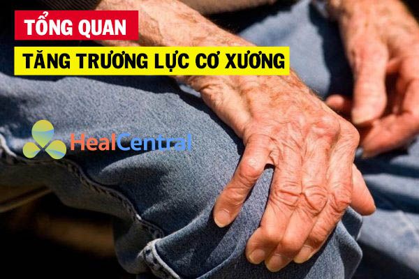 Tổng quan về bệnh tăng trương lực cơ xương