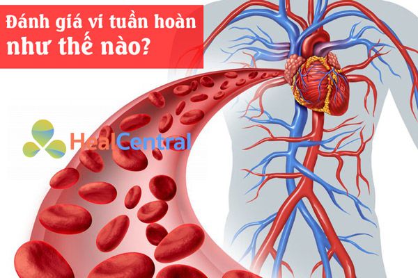 Cách đánh giá vi tuần hoàn