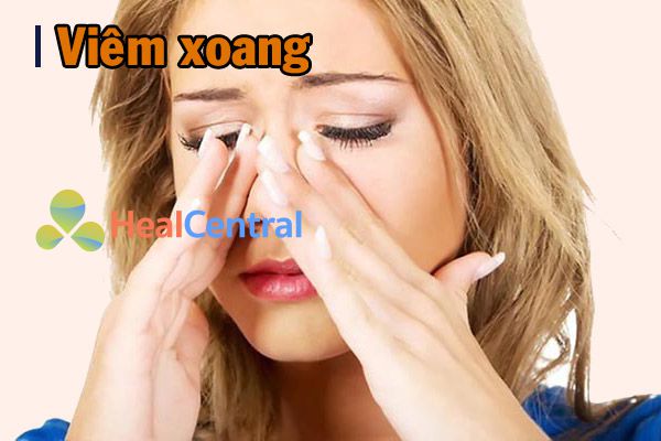 Viêm xoang là gì?