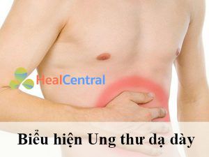 Một số biểu hiện của Ung thư dạ dày