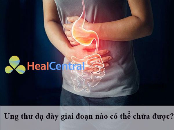 Ung thư dạ dày ở giai đoạn nào có thể chữa được