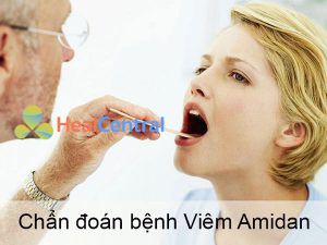 Biện pháp chẩn đoán bệnh Viêm Amidan