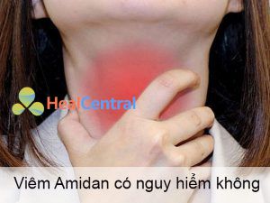 Viêm Amidan có nguy hiểm hay không?