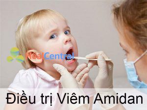 Biện pháp điều trị Viêm Amidan