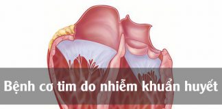 Bệnh cơ tim do nhiễm khuẩn huyết