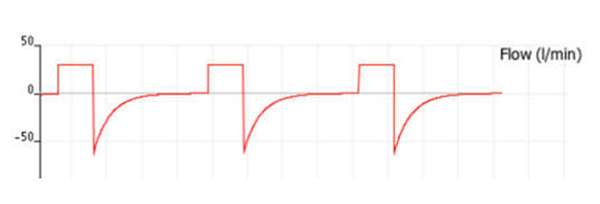 Đường cong lưu lượng thở ra về zero, bạn có thể tăng thêm tần số nếu muốn