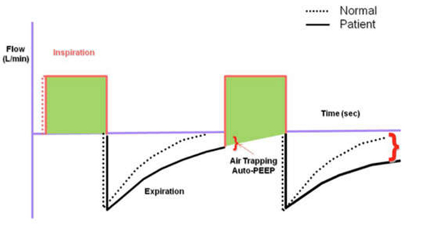 Khi đường cong lưu lượng thở ra chưa về zero khi kết thúc thì thở ra, có hiện tượng bẫy khí (air trapping) gây ra auto- PEEP
