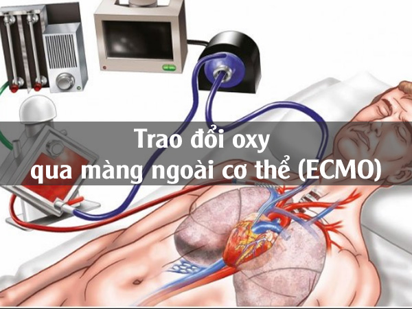 Trao đổi oxy qua màng ngoài cơ thể (ECMO)