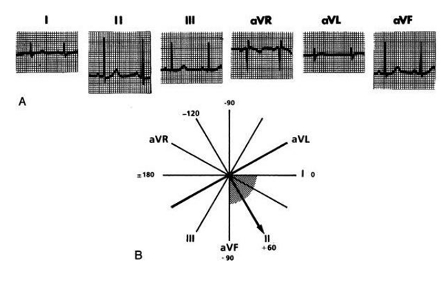 Sáu chuyển đạo chi và trục QRS