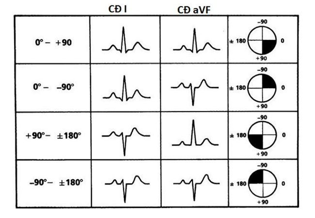 Xác định góc phần tư nghĩa là xác định trục QRS dựa vào chuyển đạo I và aVF