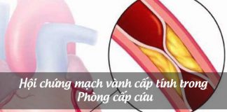 Hội chứng mạch vành cấp tính trong Phòng cấp cứu