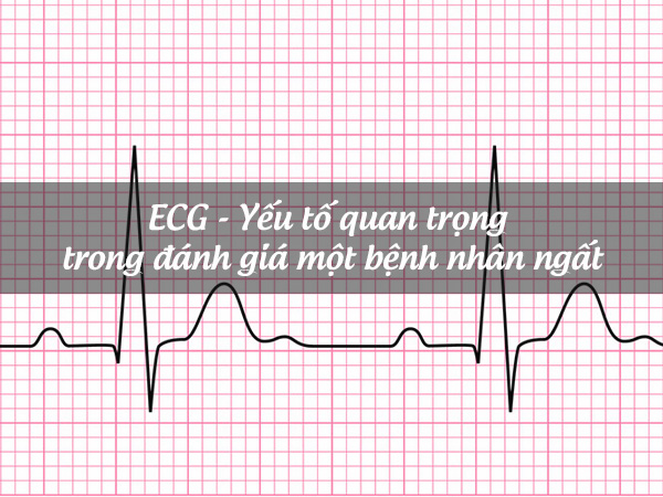 ECG là một phần không thể thiếu trong đánh giá một bệnh nhân ngất