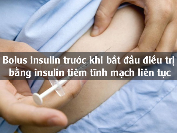 Bolus insulin trước khi bắt đầu điều trị bằng insulin tiêm tĩnh mạch liên tục