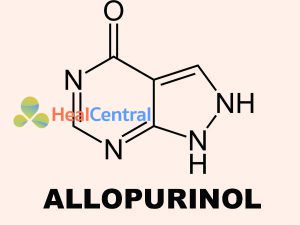 Công thức hóa học của Allopurinol