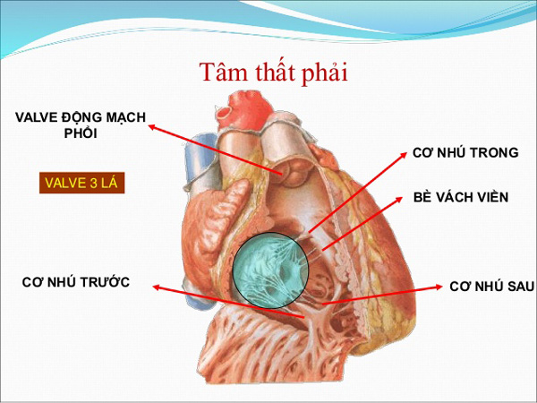 Tâm thất phải của tim