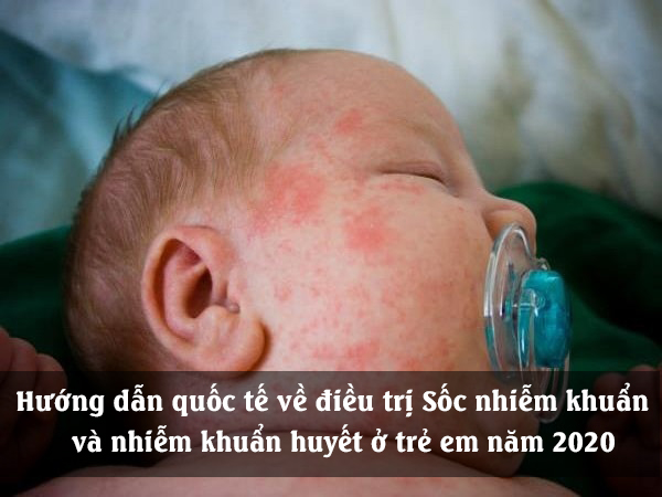 nhiem_khuan_huyet_o_tre_em_1 Hướng dẫn quốc tế về điều trị Sốc nhiễm khuẩn và Rối loạn chức năng cơ quan liên quan đến nhiễm khuẩn huyết ở trẻ em năm 2020