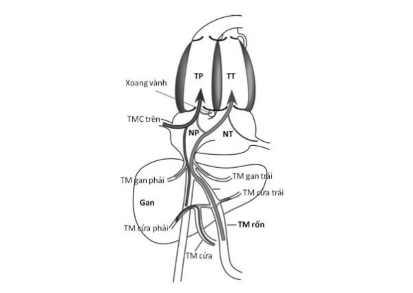 Hình 10. Kiểu ưu tiên của hồi lưu tĩnh mạch về thất phải (TP và thất trái (TT).