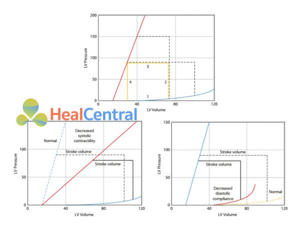 Mối liên quan áp lực – thể tích thất trái