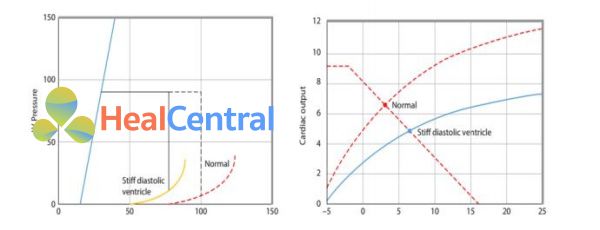chức năng tim tương ứng với mối liên quan áp lực – thể tích hình 6