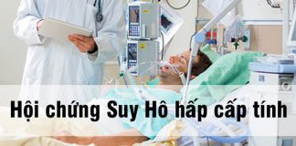 Hội chứng suy hô hấp cấp tính (ARDS)