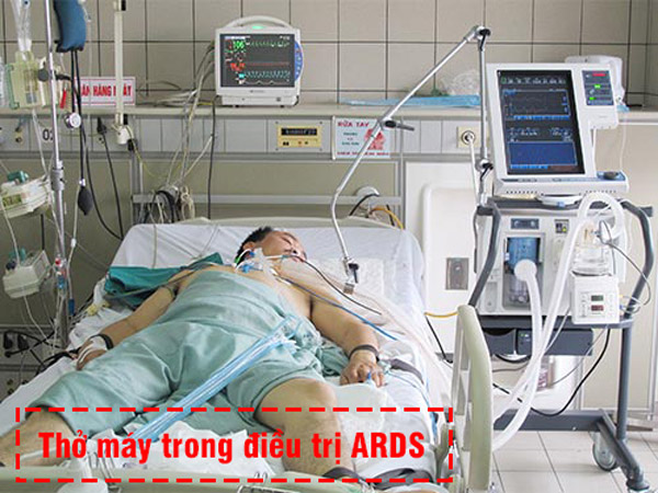 Bệnh nhân Thở máy trong điều trị ARDS