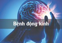 Bệnh động kinh