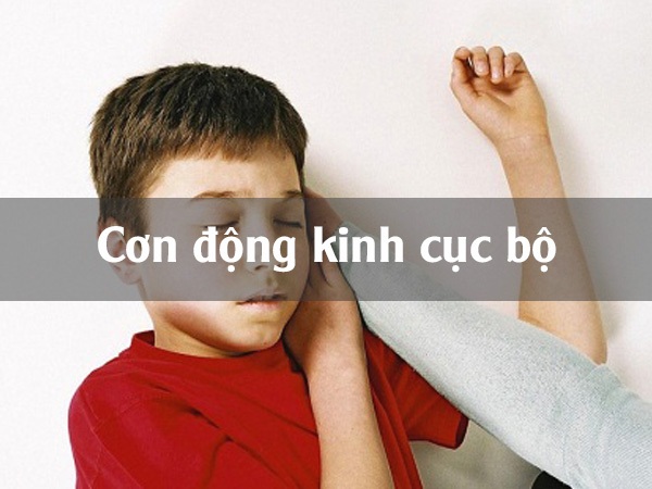 Cơn động kinh cục bộ