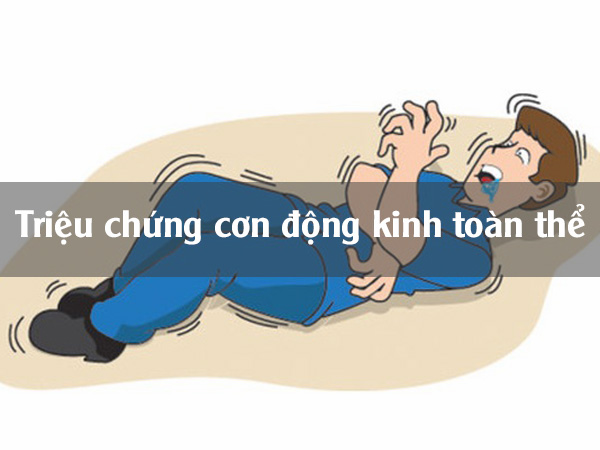 Triệu chứng của bệnh động kinh toàn thể