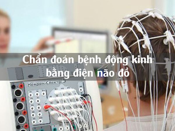 Điện não đồ chẩn đoán bệnh động kinh