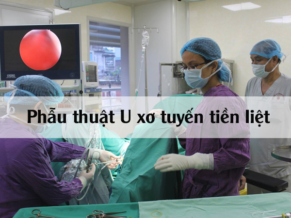 Phẫu thuật U xơ tuyến tiền liệt