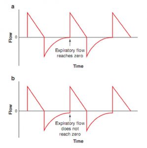 Hình 6.2 Mô hình dạng sóng lưu lượng. (a) Lưu lượng thở ra bình thường. Lưu ý rằng lưu lượng thở ra trở về zero trước khi bắt đầu nhịp thở tiếp theo. (b) Mô hình lưu lượng thở ra cho thấy nhịp thở xếp chồng. Lưu ý rằng lưu lượng thở ra không đạt đến zero trước khi bắt đầu nhịp thở tiếp theo. Sự hiện diện của lưu lượng thở ra vào cuối thời gian thở ra ngụ ý rằng áp lực phế nang cao hơn áp lực đường thở gần tại thời điểm đó.
