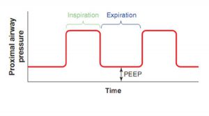 Hình 2.10 Dạng sóng áp lực biểu thị áp lực dương cuối thì thở ra (PEEP).