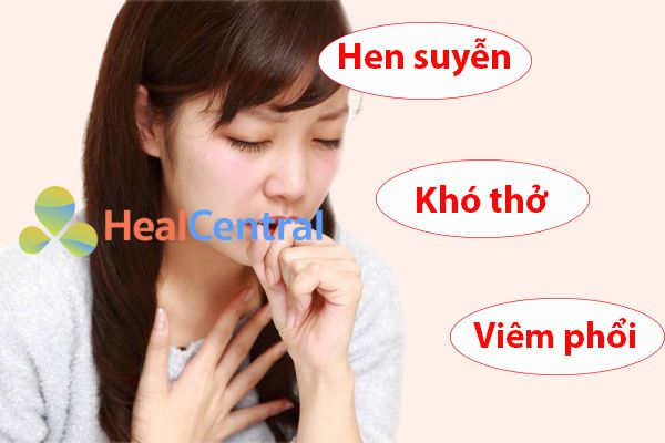 Tác dụng phụ của thuốc Cataflam