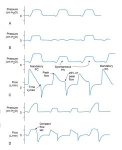 HÌNH 1.5 (A) Chế độ thông khí bắt buộc liên tục kiểm soát áp lực (PC-CMV); nhịp thở được kích hoạt bệnh nhân. (B) Thông khí kiểm soát áp lực bằng chế độ thông khí cơ học ngắt quãng tự phát (PC-IMV) với thông khí tự phát ở đường cơ sở bằng không. (C) Chế độ PC-IMV trong đó hỗ trợ áp lực (PS) đã được thêm vào cho nhịp thở tự phát. Đường cong trên cho thấy áp lực, và đường cong dưới cho thấy lưu lượng. Lưu ý rằng lưu lượng và áp lực đỉnh cao hơn đối với nhịp thở được kiểm soát áp lực bắt buộc và lưu lượng đó trở về 0 trước khi hít vào cuối. Trong nhịp thở PS, hít vào là chu kỳ lưu lượng ở mức 25% lưu lượng đỉnh. (D) Chế độ VC-IMV với PS được thêm vào để thở tự nhiên. So sánh các đường cong trên và dưới (áp lực và lưu lượng tương ứng) trong (D) với các đường cong trong (C).