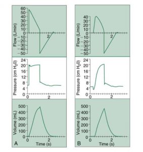 HÌNH 1.9 Hiệu quả của việc điều chỉnh thời gian tăng trong quá trình thông khí hỗ trợ áp lực (PSV). (A) Thời gian tăng nhanh hơn. (B) Thời gian tăng chậm. Từ Hess DR, MacIntyre NR, Mishoe SC, et al. Respiratory Care Principles and Practice. Philadelphia, PA: Saunders; 2002.