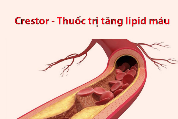 Crestor - Thuốc trị tăng lipid máu