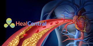 Hướng dẫn ESC/EAS 2019 về quản lý rối loạn lipid máu