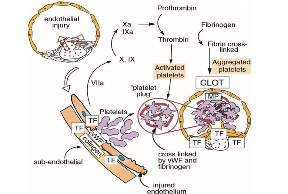 Từ sự bong mảng xơ vữa tới huyết khối