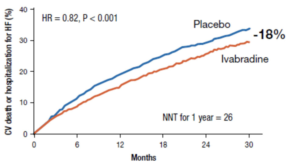 Nghiên cứu SHIfT, ivabradine làm giảm tỷ lệ tử vong do nguyên nhân tim mạch/nhập viện do suy tim nặng lên
